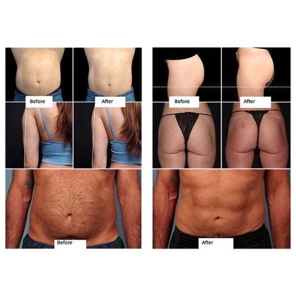 Ваять Tesla тела Emslim EM Sculpting 4 ручек электромагнитный тонкий