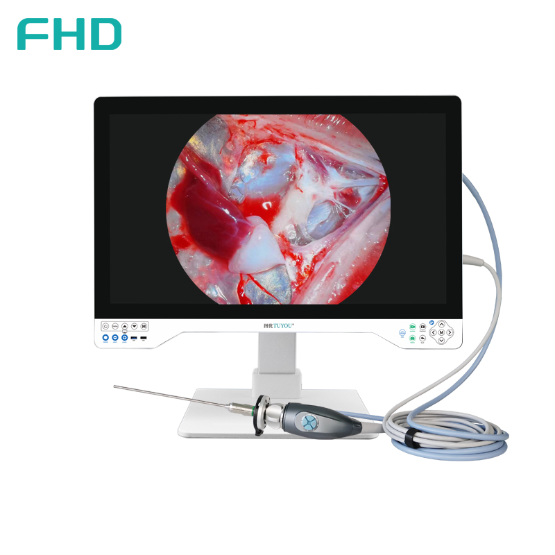 Système de caméra d'endoscopie FHD tout en un TUYOU avec moniteur chirurgical de 32 pouces pour les procédures ORL et urologiques