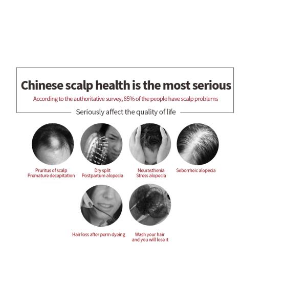 Вертикальный гребень роста волос лазера машины 650nm терапией света СИД PDT