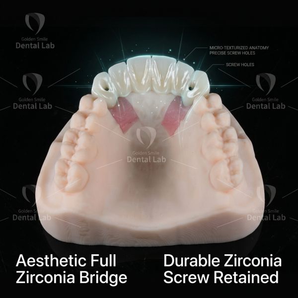 CAD CAM Digital Dental Lab Screw Retained Bridge Customizable
