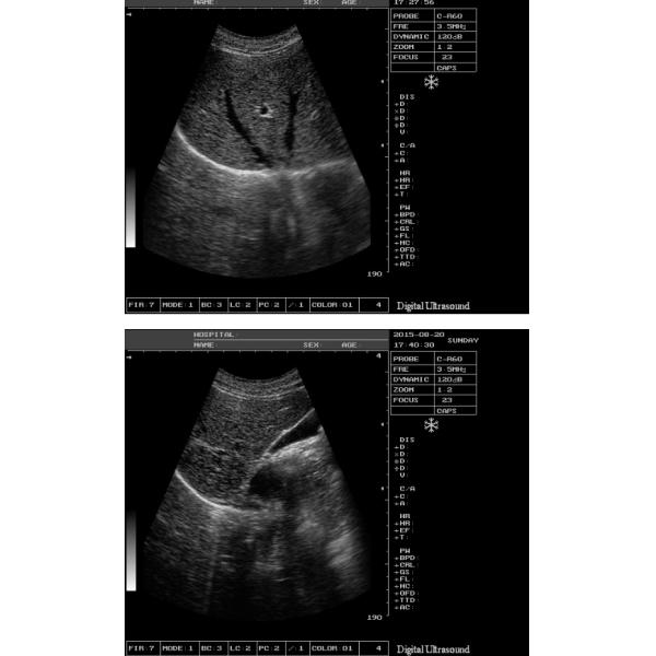 Оборудование LCD ультразвука OEM OB акушерское показывает управление TGC