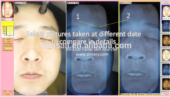 UV RGB Light Facial Skin Analysis BS-3200 Skin Analyzer