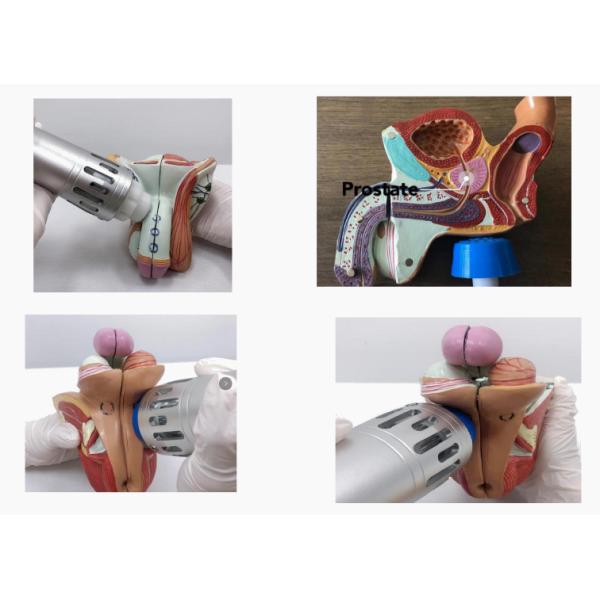 Gomecy Thérapie par ondes de choc Eélectrothérapie Ultrasons 3 en 1 Machine pour le traitement de la douleur chronique et la réparation des tissus avec l'échographie et l'électrothérapie