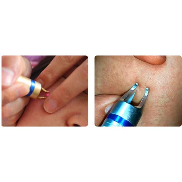 машина удаления Varicose вены удаления кровеносных сосудов лазерного диода 30w 980 васкулярная