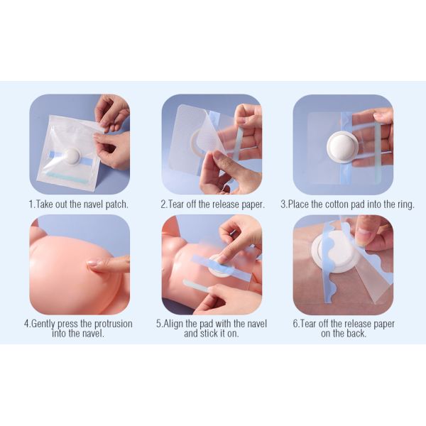 Skin Friendly Breathable Clear Wound Dressings for Baby's Navel Neonatal Hip Hernia