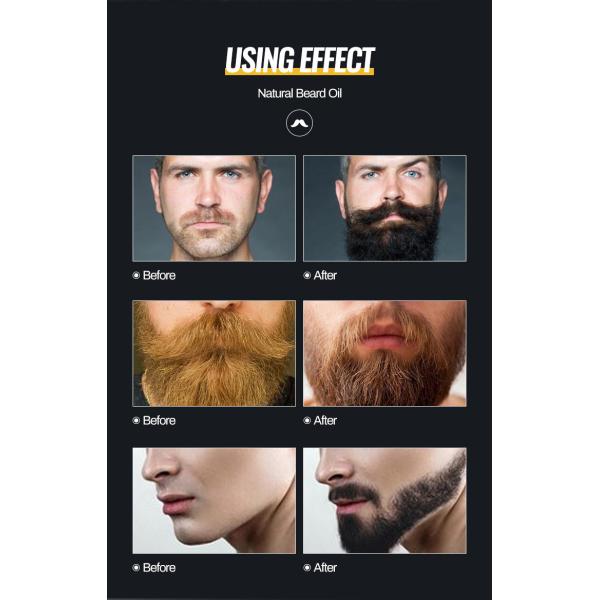 OEM Beard Growth Oil Beard Growth Softens Strengthens