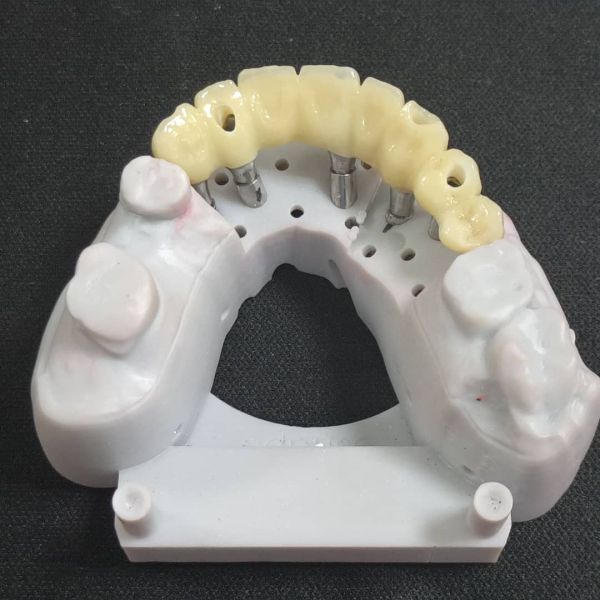 Customized Dental Zirconia Crown Bridge Implant Bar Using 3D Laser Printing
