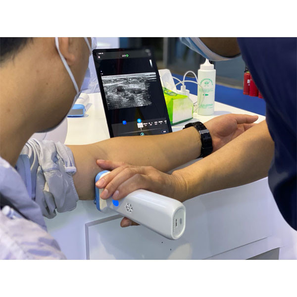 DICOM BMP PNG JPEG 128 Element Wifi Ultrasound Probe 80 To180dB