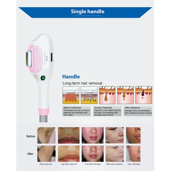 360 Magneto-optics laser Beauty Machine Vertical laser hair removal machine Laser mole removal Multi-handle laser machine