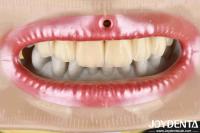 Layered Zirconia High Aesthetics Excellent Biocompatibility Sintering Temperature 1350-1450°C For Advanced Materials