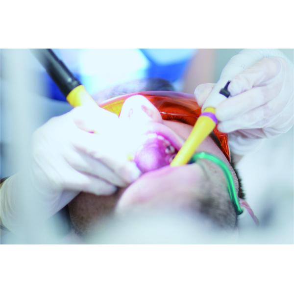 150 мм Стоматологические расходные материалы Стоматологические сосочные кончики одноразовый портативный выбрызгиватель слюны