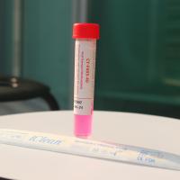 tubo medio de muestreo 1mL del transporte viral disponible del tubo con la esponja