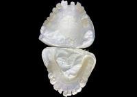 Les prothèses dentaires partielles flexibles Valplast sont réglables pour améliorer la mastication et la parole.
