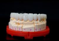 Coroas de zircônio com ajuste preciso, coroas de zircônio altamente biocompativeis para dentes.
