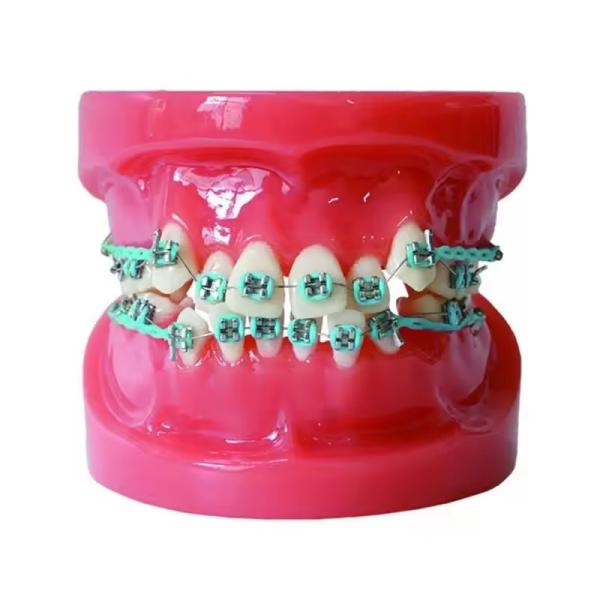 Treinamento Uso de Dentes Dentários Modelo de Ensino Modelo Ortodôntico Dental Funcional Sem Bracket