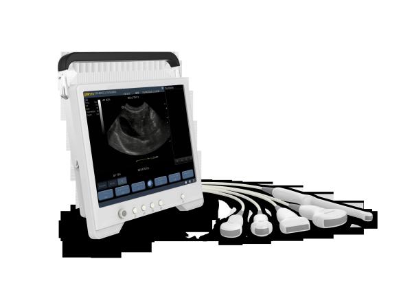 TS20 Digital Diagnostic Ultrasound System for Obstetrics and Gynecology Department