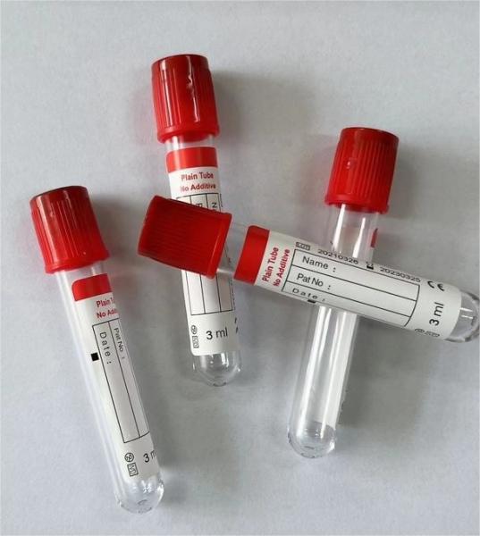Smooth Inner Tube Wall Prevents Blood Cell Attachment in Plain Vacuum Blood Collection Tube 1ml-10ml