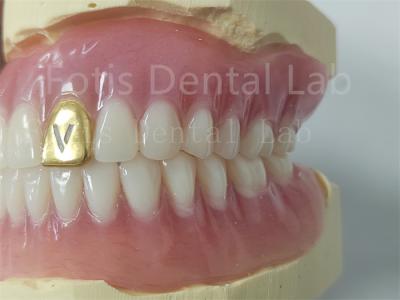 Customizable Full Denture Acrylic Teeth Odor Resistant Comfort Fit