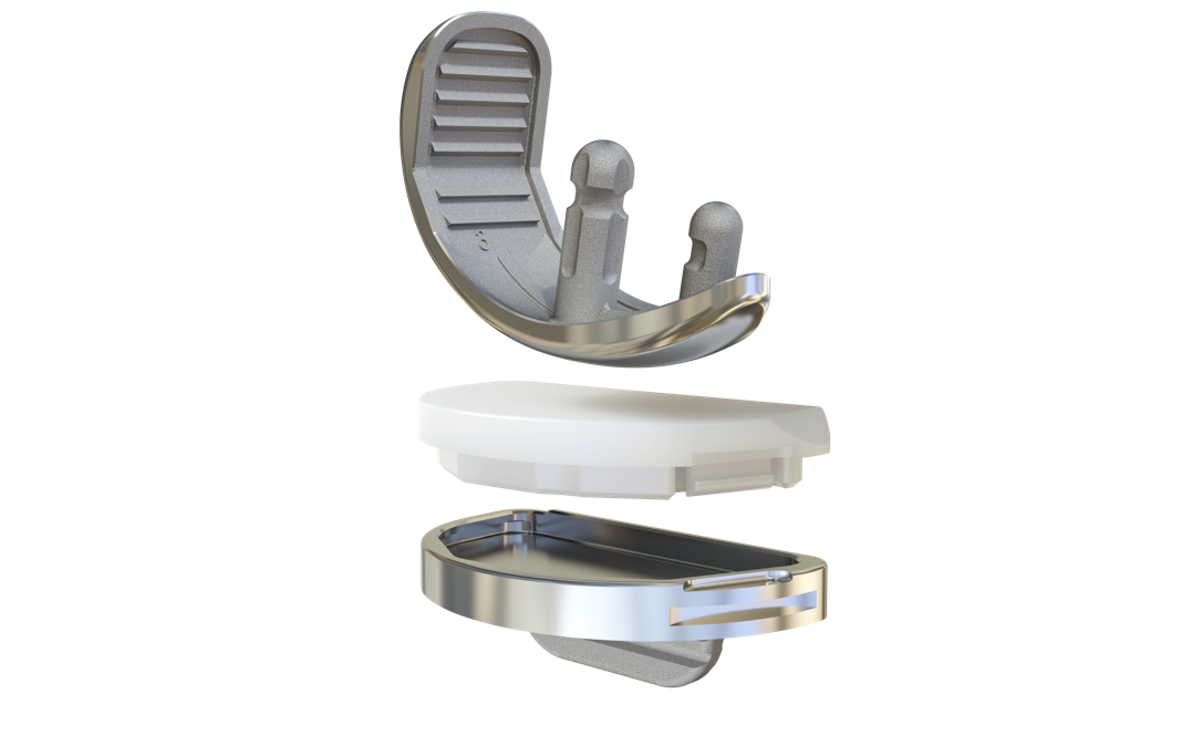 Unique Unicompartmental Knee System