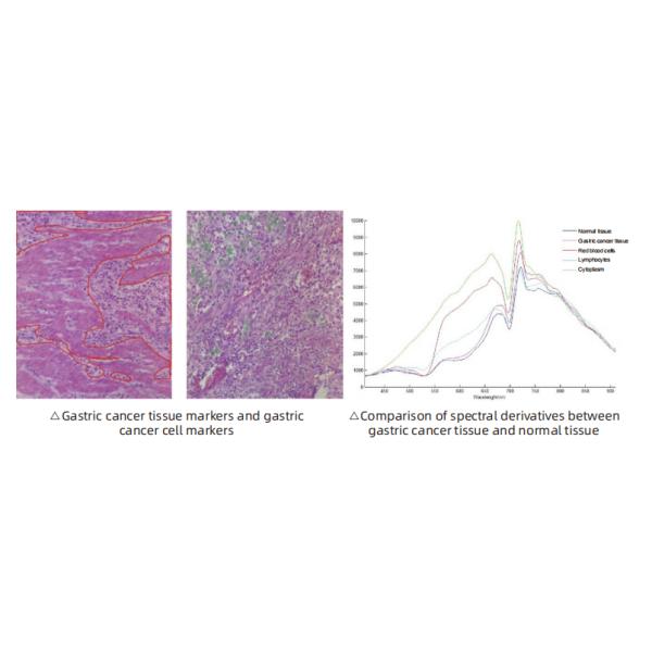 Detection Staining Microscopic Hyperspectral Imaging System With Lens & Microscope