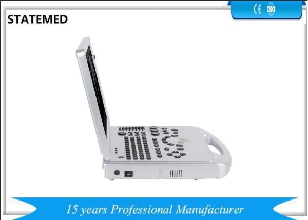 Medical Equipment Color Doppler Ultrasound Scanner Portable Ultrasound Machine