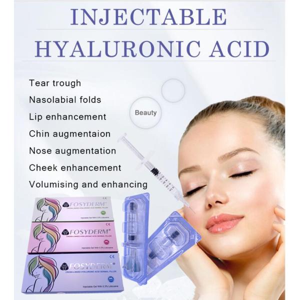 Hyaluronic кисловочный дермальный вводимый заполнитель для стороны носа
