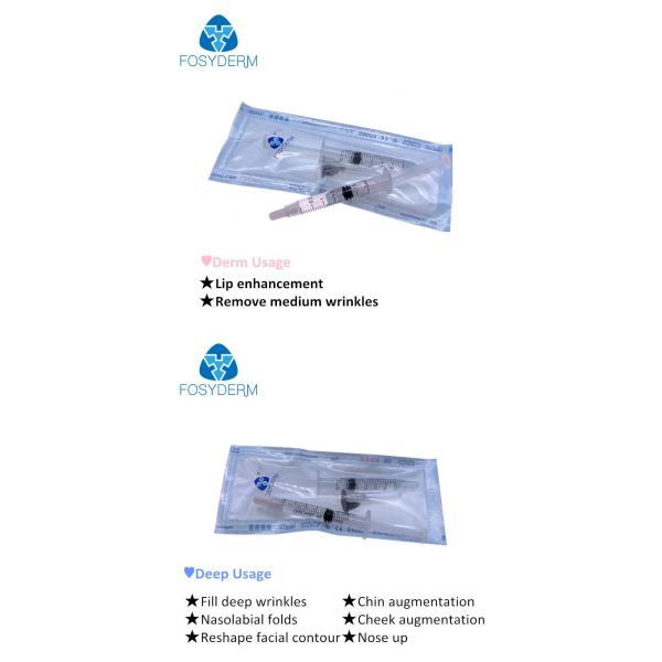 Продукт заботы кожи заполнителей губы Хялуроник кислоты Фосйдерм для пользы ручки Хялурон