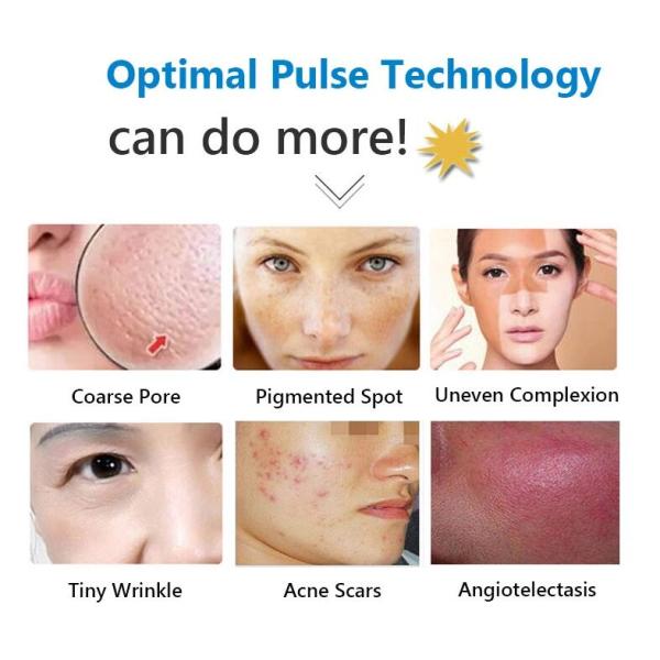 Professional SHR Hair Removal Machine , E - Light IPL Beauty Machine