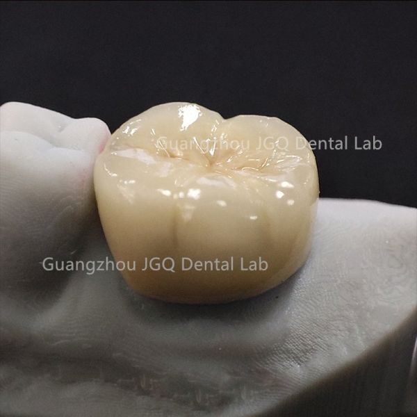 Custom Zirconia Restorations Professional Dental Lab for Global Dental Clinics