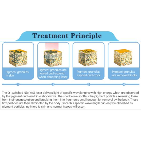 Most professional laser tattoo removal machine beauty equipment q switched nd yag laser