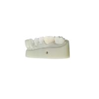 OEM 3D a imprimé la conception dentaire du DAO FAO de modèles pour le laboratoire de dentier
