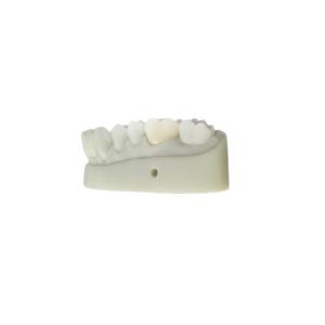 O OEM 3D imprimiu o projeto dental do CAD CAM dos modelos para o laboratório da
