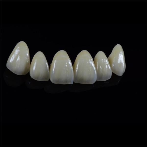 Tooth Multi Layered Zirconia Crown for Restorative Dentistry