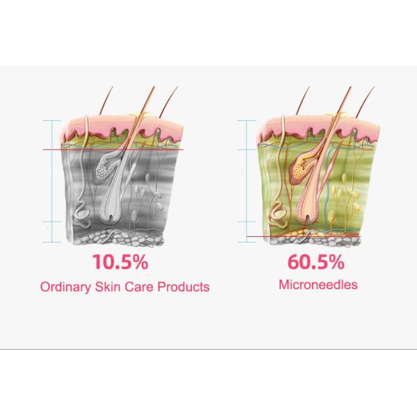 Portable Needle Free Mesotherapy Beauty Therapy Machine Anti Aging Skin Rejuvenation