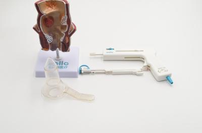 Short Recovery Time Piles Treatment Stapler Surgery , Staple Operation Of Piles At Home