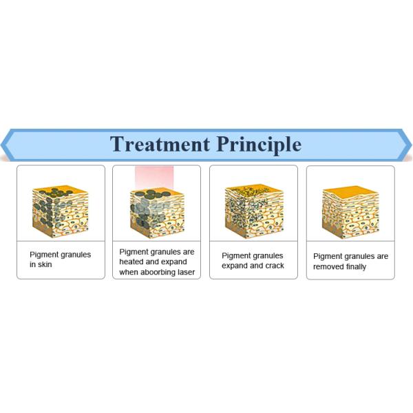 1600Mj ND YAG Laser Laser Eyeliner Washing Eyebrow Removal Tatoo Removal with Medical CE approved