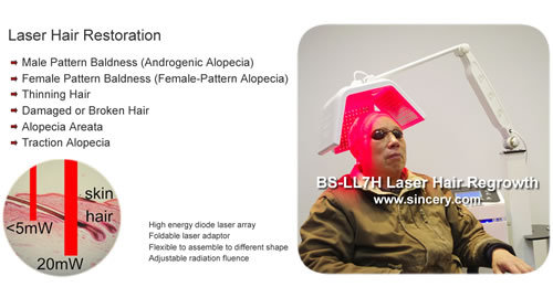 Best quality! PDT LED Diode Laser Hair Growth Machine