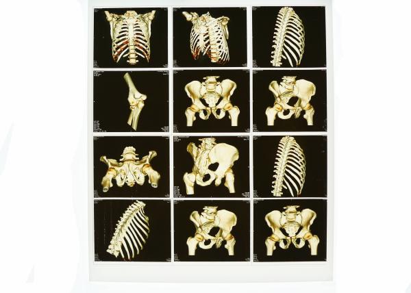 Wearable White Base X Ray Diagnostic Imaging , Medical Laser Blue X Ray Film