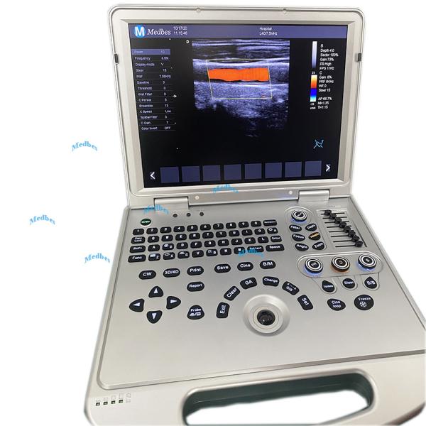 Chinese Full Digital Laptop 4D 5D Human Color Ultrasound Scanner portable Laptop ultrasound machine for pregnancy