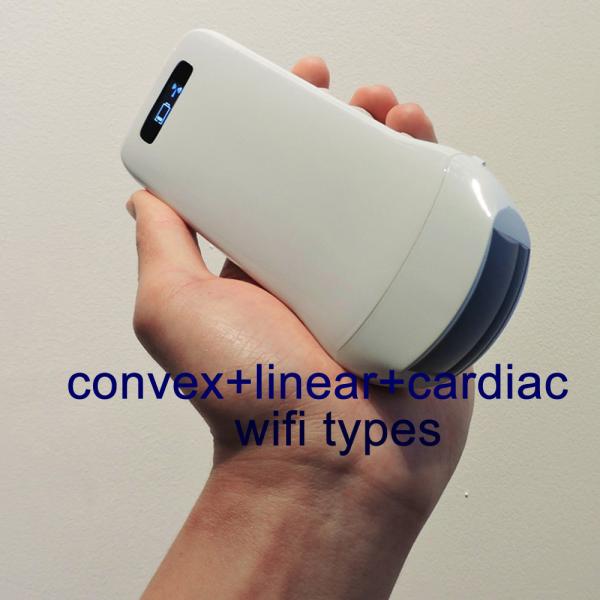 DICOM Medical Hospital Equipments 128 Element Portable Wifi Wireless Ultrasound Scanner