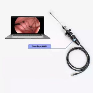 TUYOU 1080P USB Endoscope Camera for ENT Laparoscopy Gynecology