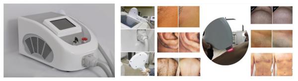 A good news for all hair removal problem! Painless and quick 808nm diode laser machine