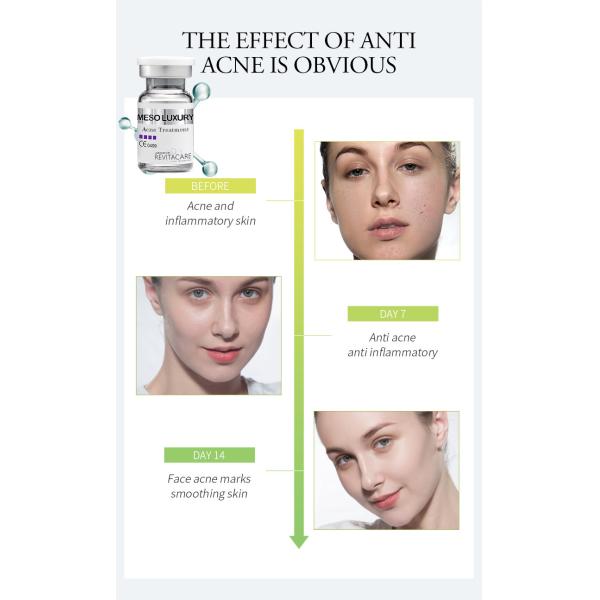 Skin Beauty Acne Treatment Collagen Anti Scars Skin Whitening Repair Hydrating Facial Essence