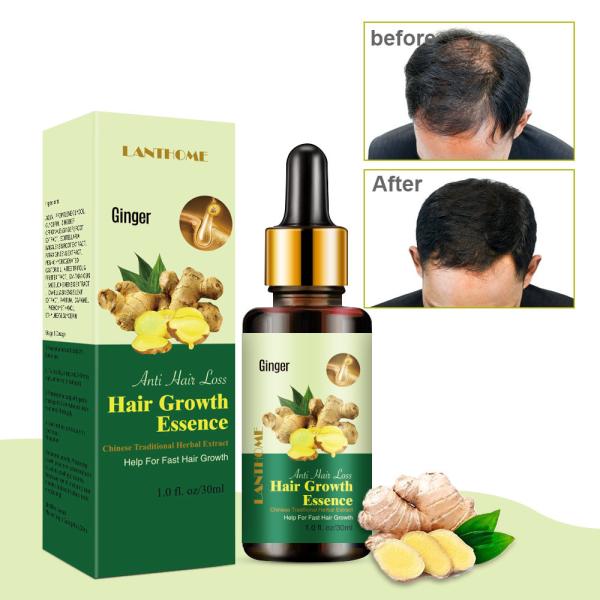 ODM Hair Regrowth Serum 7 Days Ginger Oil 30ml For Repairing