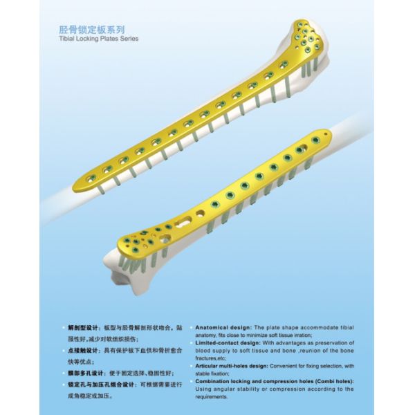 Platee y atornille las placas intermedias de la plataforma tibial yo (L/R) un implante más bajo del titanio de los miembros
