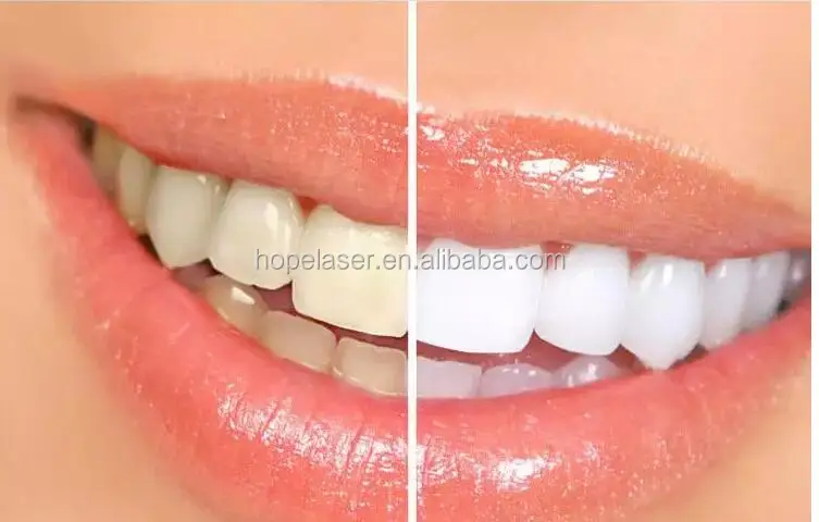 New type econormical LED Teeth whitening machine / tooth whitening device / teeth cleaning machine