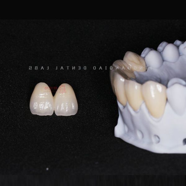 Zirconia Crown Bridge Dental Laboratory China High Accuracy CE FDA ISO Standard