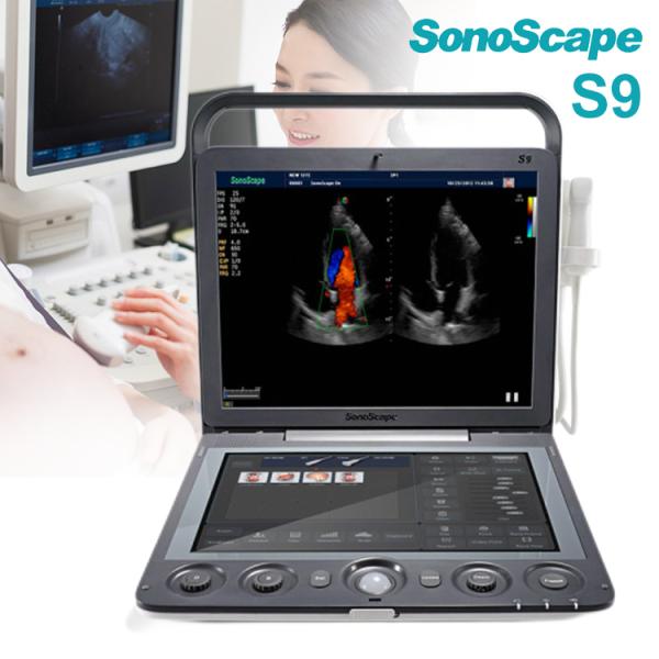 Portable 3D 4D Color Doppler USG&Sonoscape S9