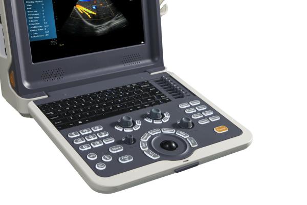 Factory price color doppler portable ultrasound scanner