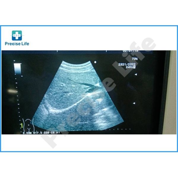 Aloka UST-9130 ultrasound probe Convex array UST-9130 Ultrasound transducer